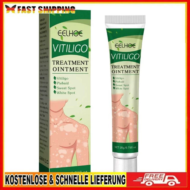 20 g crema macchie di sudore promozione melanina bianca trattamento macchie crema salute corpo