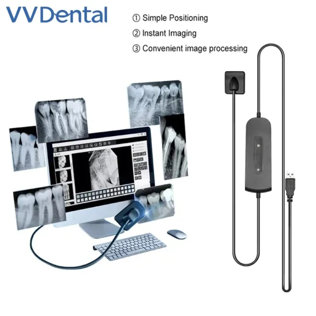 VVDental Dental Sensor X-Ray Radiovisiograph Digital Sensor Intraoral Imaging Sy