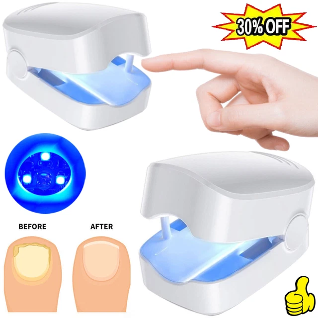 ANTI FUNGAL LASERDEVICE Finger Toe Nail Fungus Remover Onychomycosis
