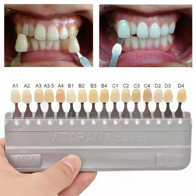 VITAPAN Classical Shade Guide Dental Materials A1-D4 16 Colors Teeth Whitening