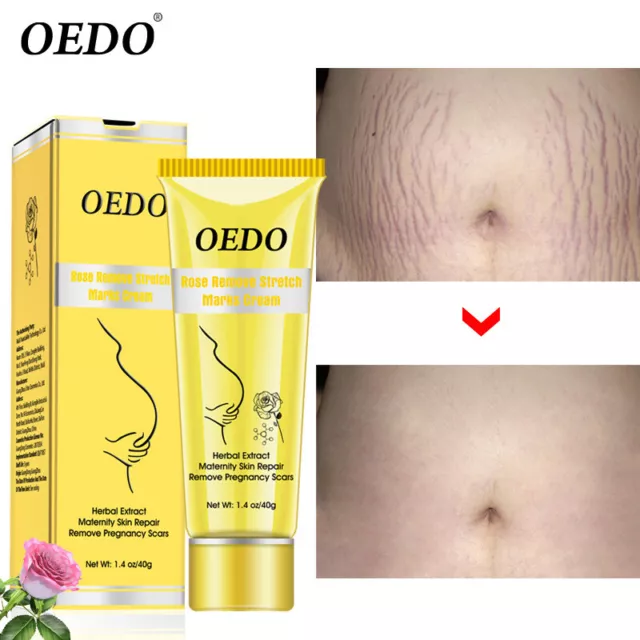 Crema de eliminación de cicatrices OEDO para cicatrices viejas manchas elásticas gel para hombres y mujeres