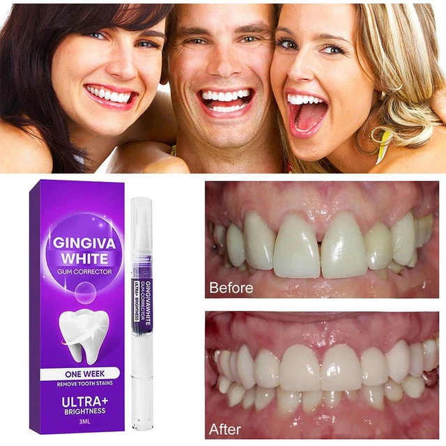 Purple Gum Therapy Gel, Gum Instant Soothing Gel  for Sensitive Teeth Pens