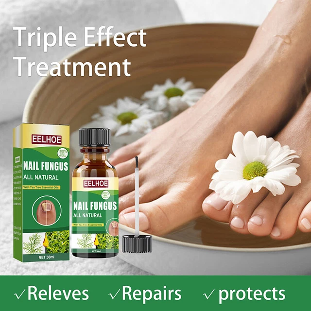 Meilleur Fongique Traitement Ongles - Stop de Pied, Doigt,Champignon Infectio,