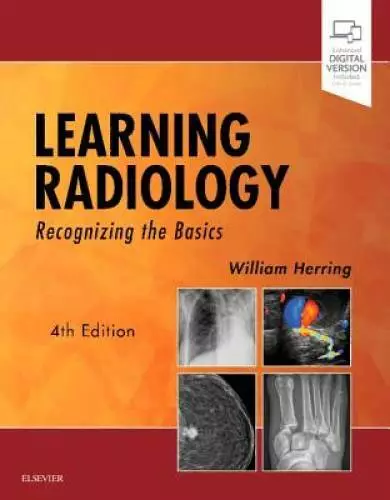 Learning Radiology: Recognizing the Basics - Paperback - GOOD