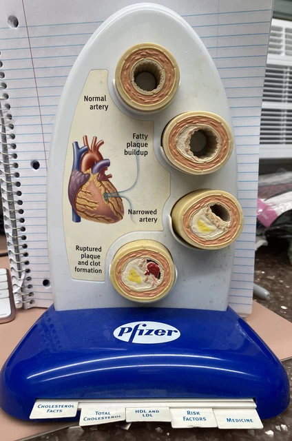 pfizer Cholesterol And Heart Disease Display 2004