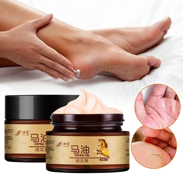 Horse Oil Hand Foot Cream, Natural Horse Oil Foot Repair Cream, Moisturizer