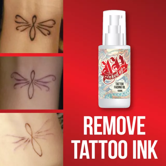 Inked Up Tattoo Fading Oil – Remove Tattoo Get Rid Of Ink Clear Skin Fast Work