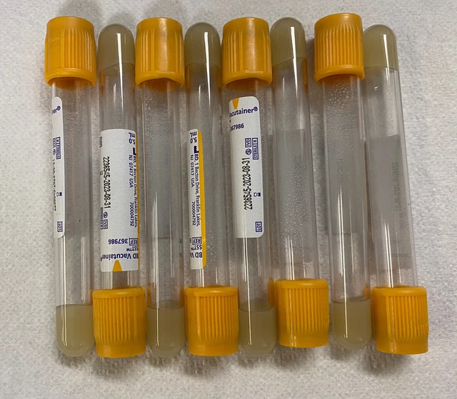 SST YELLOW/GOLD TOP Gel Tubes 5 mL Phlebotomy Nurse Lab (Pack of 50