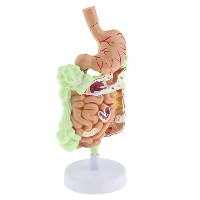 Human Stomach Gastrointestinal Digestive System Model