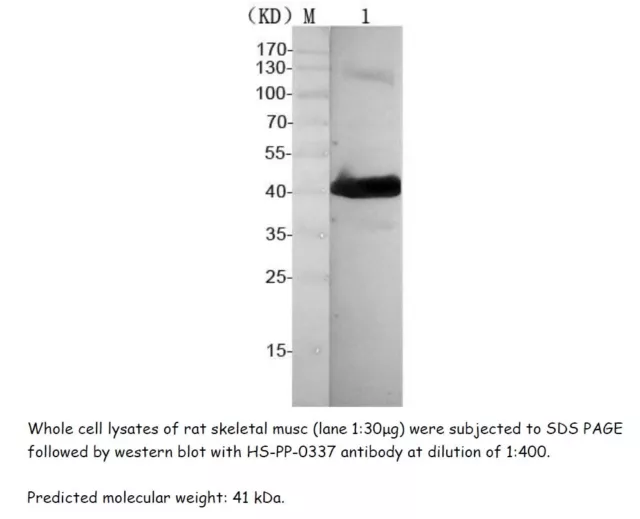 Rabbit anti-Human MAPK1 Polyclonal Antibody, 100uL, www.sunnybiotechnology.com