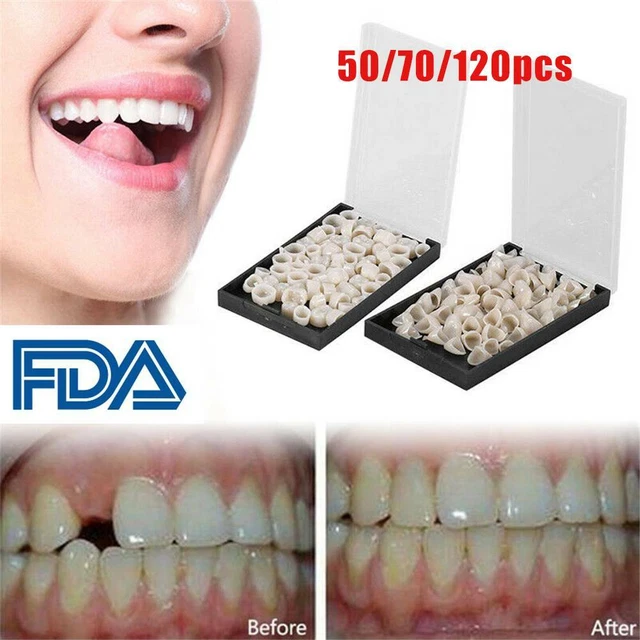 TEMPORARY CROWNS POSTERIORS Anterior Molar Resin Tooth Teeth Caps