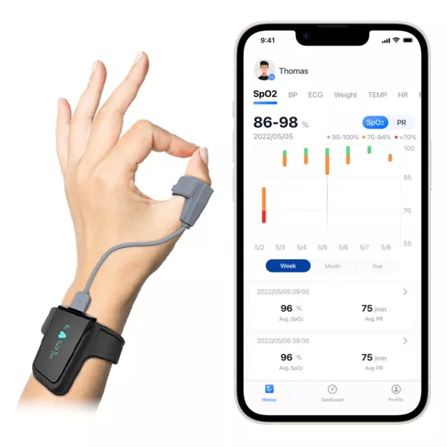 Plusoximeter für das Handgelenk mit alarm,72 Stunden Überwachen SpO2 Schlafapnoe