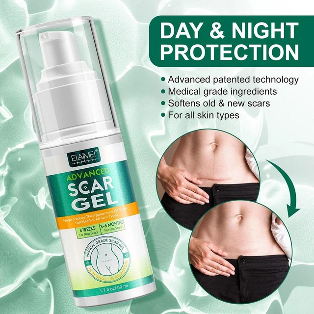 ELAIMEI Advanced Rimozione Cicatrici Gel Unguento Stretch Segni Cicatrici Crema Riparazione Bruciore
