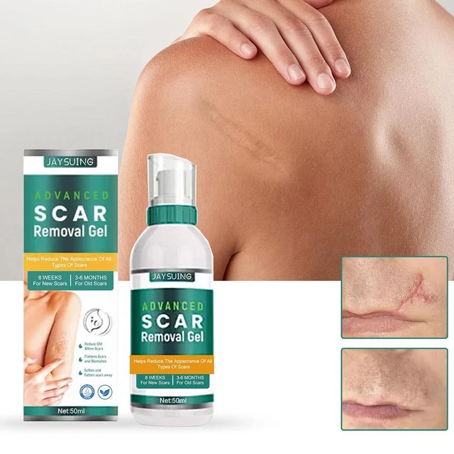 Advanced Scar Gel Abdominoplastia Cicatrices Viejas Marca elástica Cicatrices Quemar BEST 2023 H8Z3