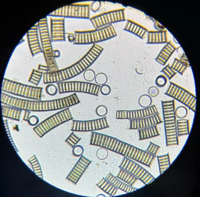 19th c J.D. Moller Microscope Diatom Slide England Melosira Arenaria Moore