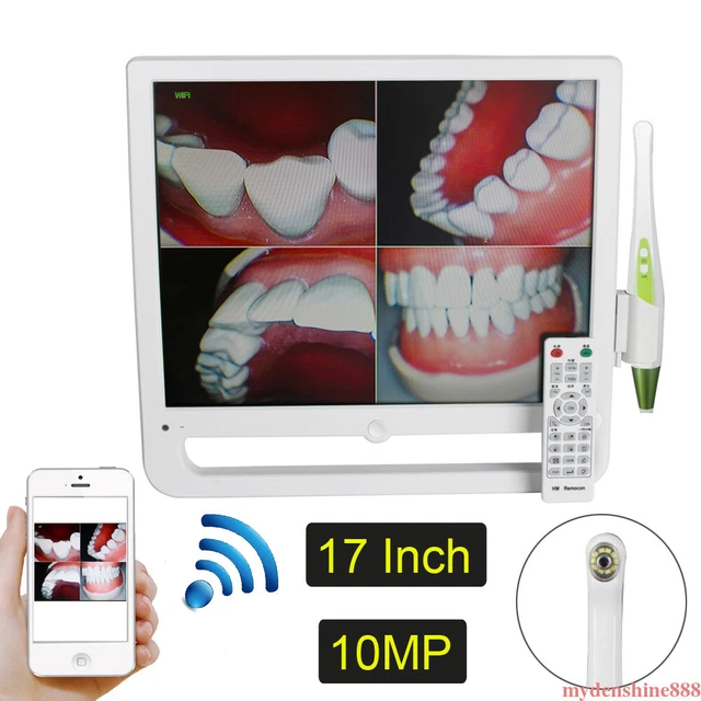 17" WIFI Digital AIO Monitor 10MP Dental Intraoral Camera High Resolution 6 LED