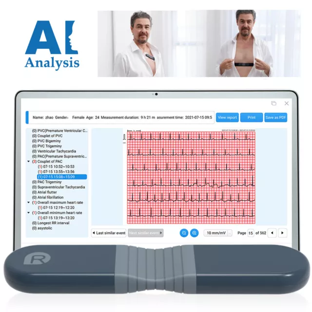 US stock Wellue Portable Dynamic ECG EKG Holter Recorder 24 Hours PC AI analysis