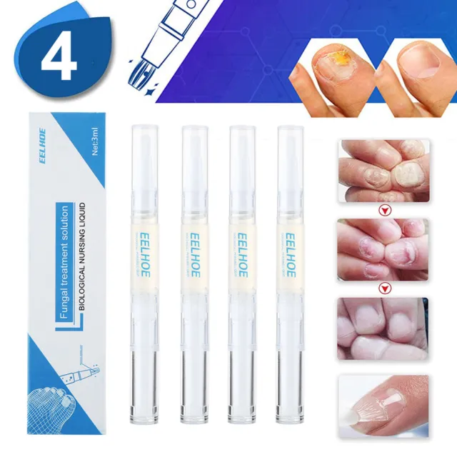 4/10 Stück Anti Nagelpilz Stift Nagelpilz Behandlung Nagelpflege Nagelreparatur