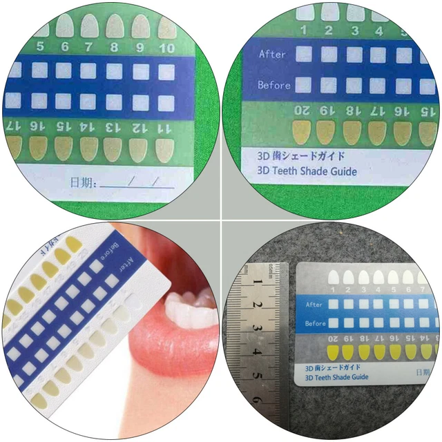 CARTA COLORI DENTI PVC mappe colori denti tabella di confronto per ...