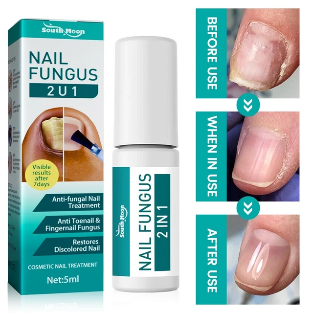 4 ml Pro Anti Fúngico Tratamiento de Uñas Reparación Dedo Puntera Cuidado Uñas Hongos Pluma Líquida