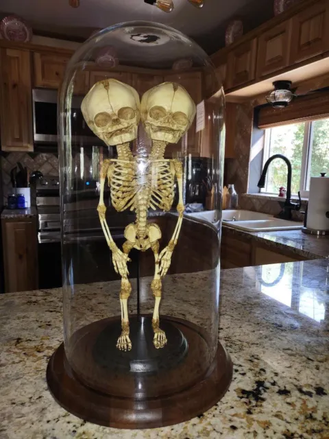 oddities and curiosities - Conjoined skeleton replicas under glass