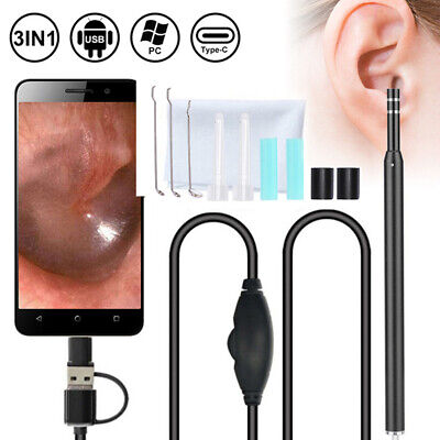 Limpieza de oídos visuales 3 en 1 USB cuchara eliminación de cerumen KiLOS0