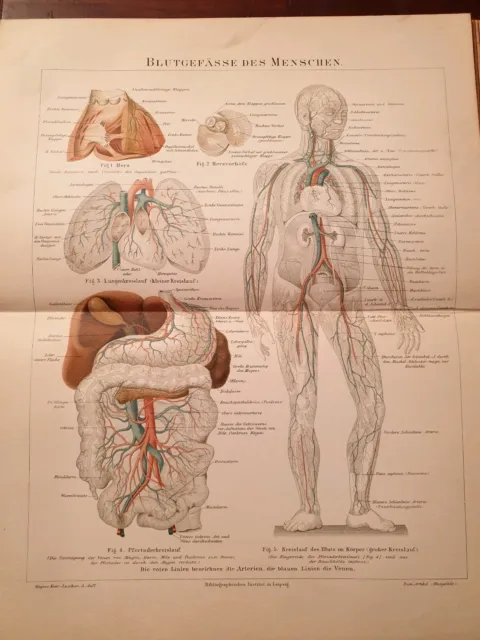 Blutgefäße des Menschen, Medizin, Lithografie 1895 Arterie Vene Aorta Herz Lunge