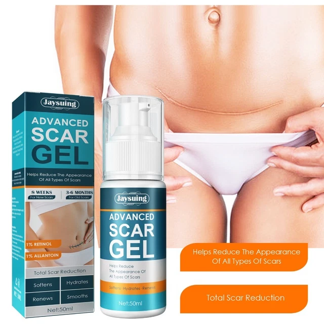 rápido Crema de eliminación de cicatrices Cicatrices viejas Gel de cicatriz