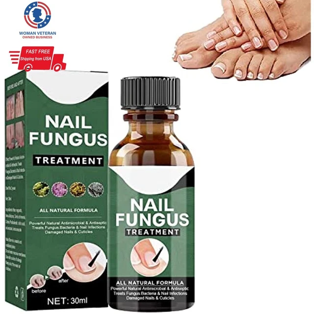 ANTI FUNGAL NAIL Treatment fungu Nail Finger Toe Fungus Onychomycosis