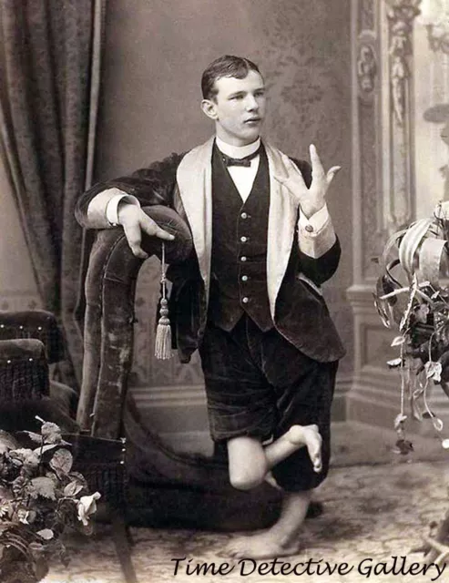 Circus Side Show Freak with Claw Hands - Historic Photo Print