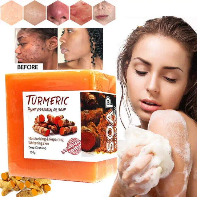 Jabón blanqueador de piel cara todo cuerpo natural aclarante aclarador manchas