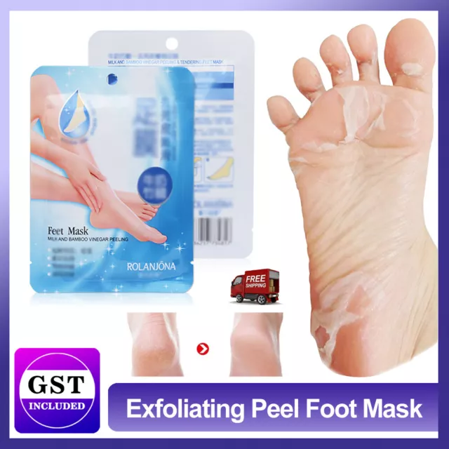 1-10 Pair Exfoliating Peel Foot Mask Baby Soft Feet Remove Callus Hard Dead Skin