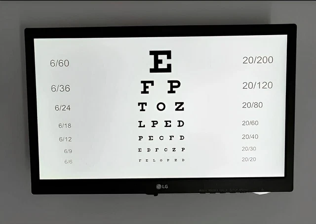 Branded Digital LED Vision Eye Chart Ophthalmic LED Eye TEST Visual Acuity Chart