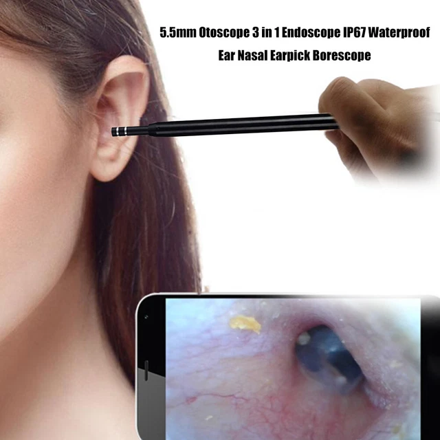 Endoscopio 3 in 1 fotocamera selettore orecchie visivo orecchio bocca naso otoscopio -