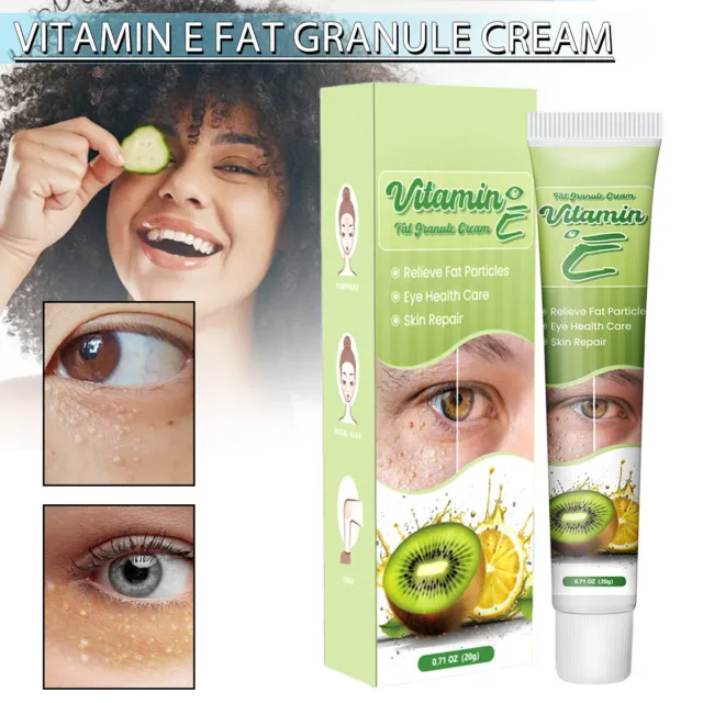 Vitamin E Fat Granule Eye Cream Improve Eye Bag Firming Moisturizing Skin C