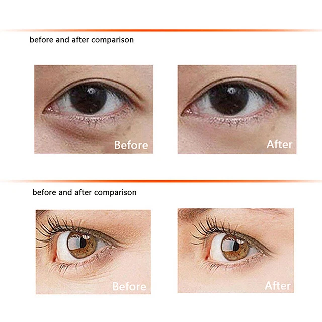1Pair Eyelash Pad Eye Masks Anti Wrinkle Patch Washable Soothing And Wrinkle EI