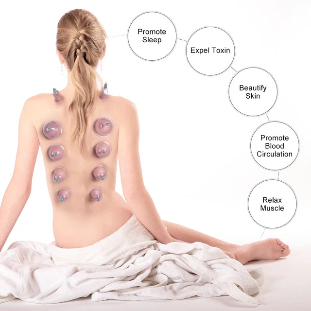12x Saugnäpfe Schröpfen Massage Akupunktur Vakuum Therapie Traditionell GD2