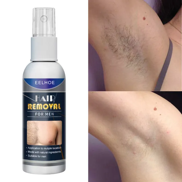 Spray depilazione inibitore della crescita dei capelli delicati depilatorio (maschio 50 ml) -de