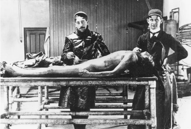 Antique Autopsy Photo 565b Oddleys Strange & Bizarre