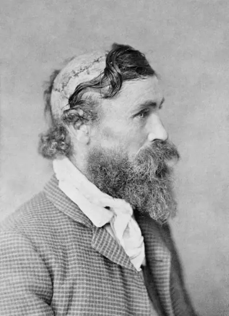 Antique Civil War Medical Photo 454b Oddleys Strange & Bizarre