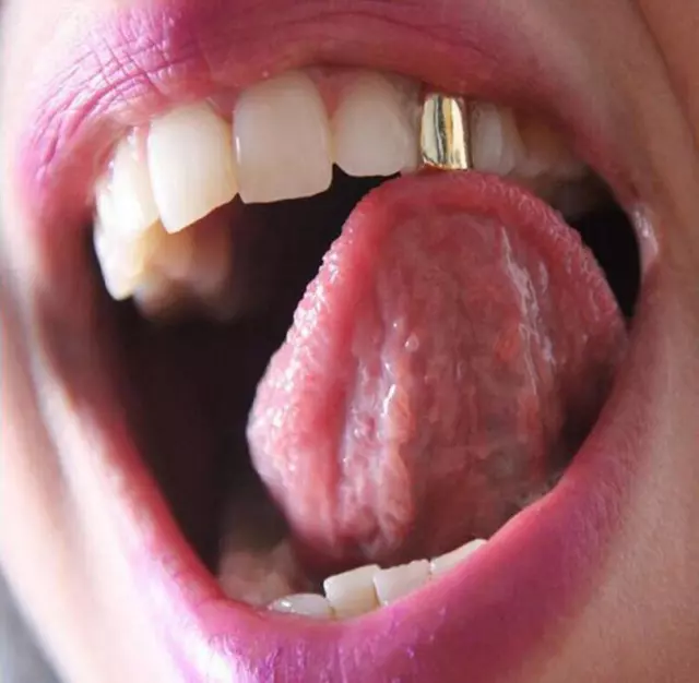Comfort Custom 14k Gold Plated Small Single Tooth Cap Grillz Hip Hop Teeth Grill