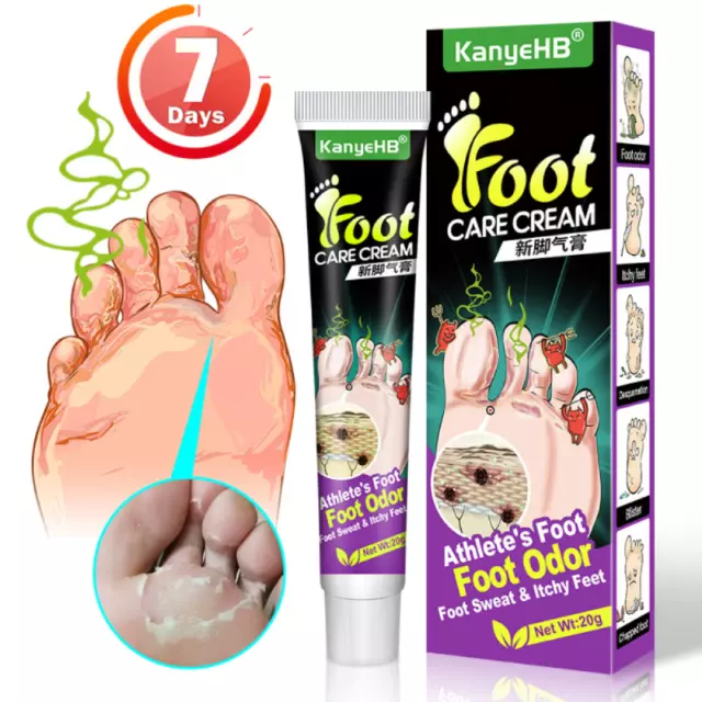 20g Athlete's Foot Cream 7 Days Fast Effective Foot Care Anti/fungal Ointment