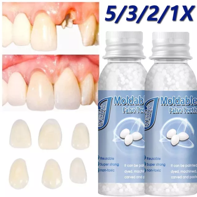 5-1x Temporary Tooth Repair Beads for Missing Broken Teeth, Dental Tooth  Filling