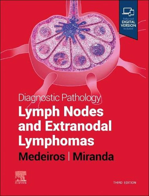 DIAGNOSTIC PATHOLOGY: LYMPH Nodes and Extranodal Lymphomas 3rd Edition ...