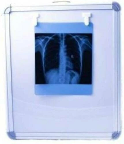 Led X Ray 1714 Viewer Illumination With High Brightness With Free Shipping