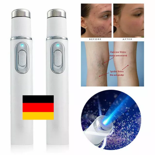 LCD Laser Plasma Pen Maulwurf Dunkler Fleck Haut Warze Tag Tattoo Entfernung