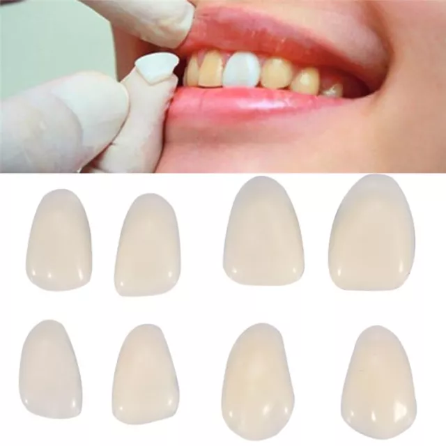 100Pcs Dental Temporary Crown Veneers for Anterior Front Teeth Whitening 2