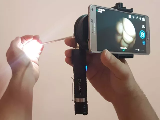 Adattatore per endoscopio smartphone ClaraMed con sorgente di luce LED...