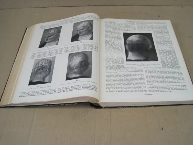 Buch mit dem Titel:MEDIZINISCHE WELT 1927 Ärztliche Wochenschrift gebunden selt. 7