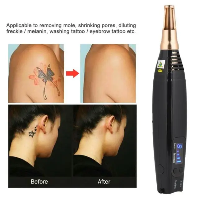 Blue Laser For Scar Tattoo Removal Pen PicoSecond Therapy Kit